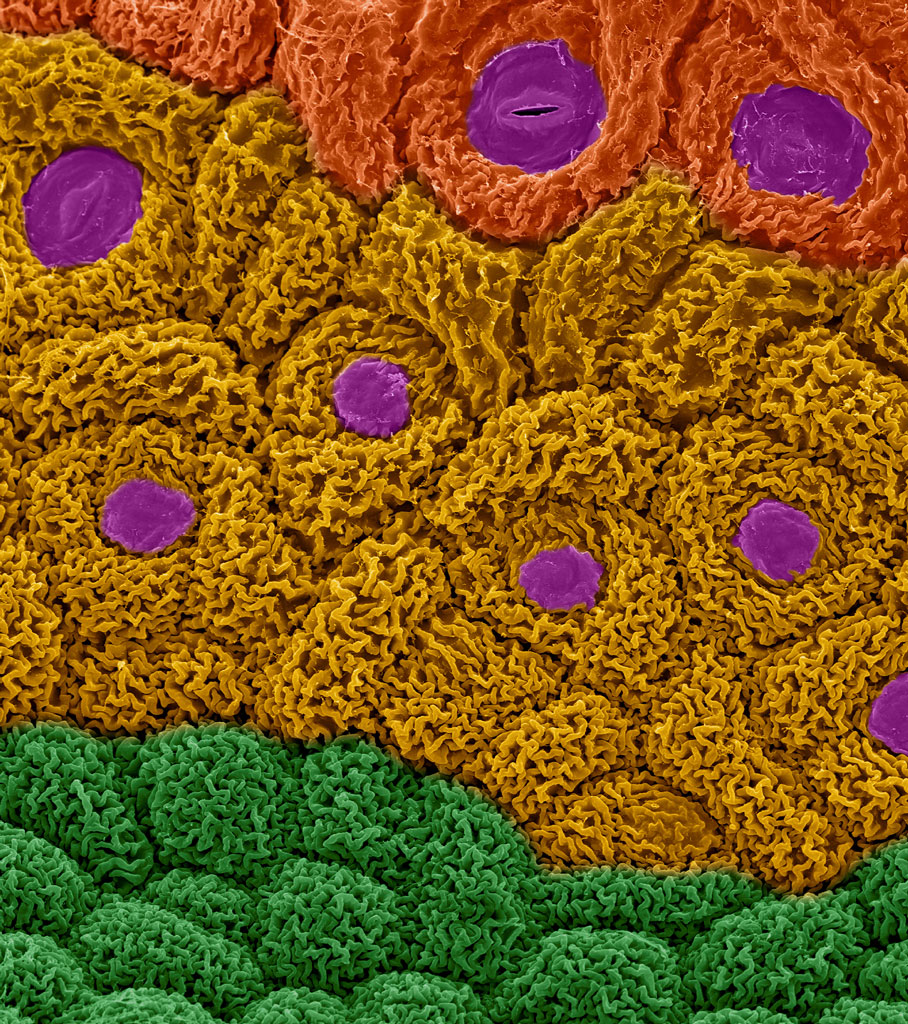 Broccoli Differentiating Apical Meristem, Electron Microscope Photography Dennis Kunkel