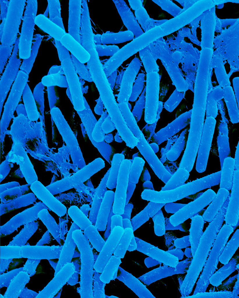 Propionibacterium Acnes - skin rod prokaryote, Electron Microscope Photograph Dennis Kunkel
