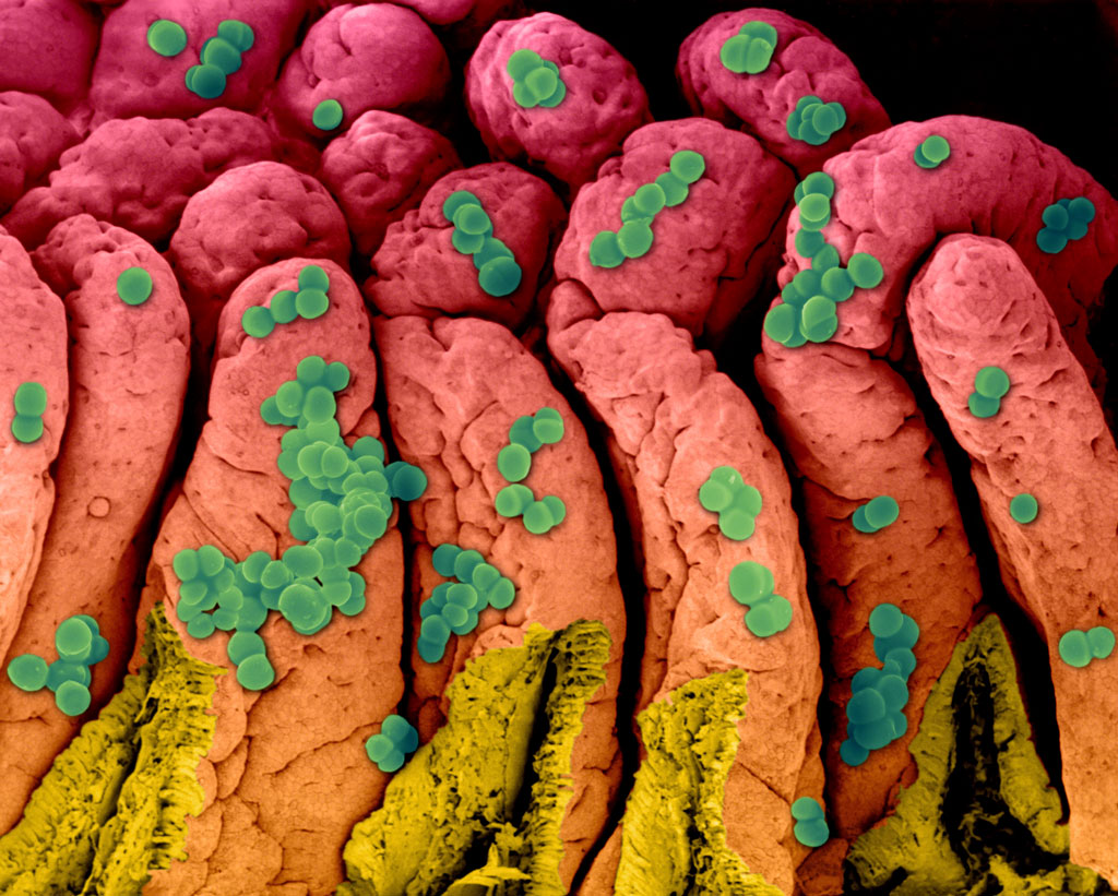 Staphylococcus aureus Bacteria, Electron Microscope Photograph Dennis Kunkel