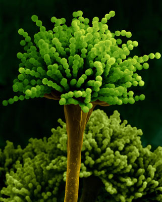 Molding Fruit Structure, Aspergillosis fungus, Electron Microscope Photograph Dennis Kunkel
