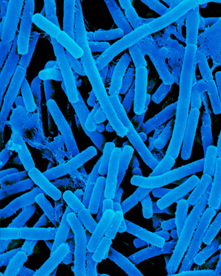 Propionibacterium Acnes - skin rod prokaryote, Electron Microscope Photograph Dennis Kunkel