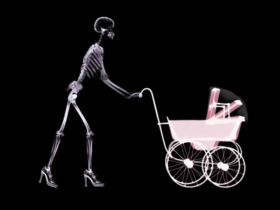 X-Ray, Baby in a Stroller