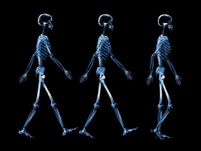 X-Ray, Men Walking